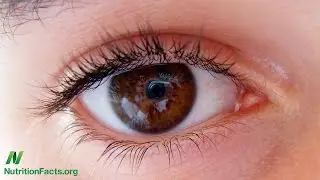 Dietary Prevention of Age-Related Macular Degeneration