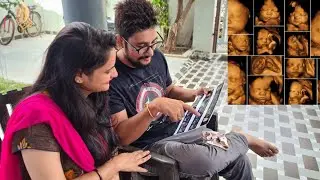 Baby UltraSound me Kitna clear dekh rha hai😘|| Snappy girls || @THEROTT ||