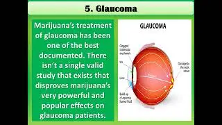 Europe Medical Marijuana Shop Online