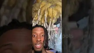 Bleaching Dreads GONE WRONG! 😨