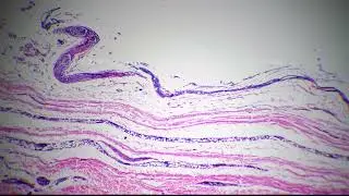 Microscopic 40x image of human skin with sweat glands against bright field