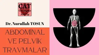 Pelvik Travmalar Nurullah Tosun