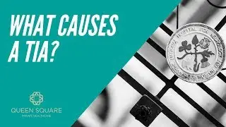 What are the causes of TIA or mini stroke? - Dr Arvind Chandratheva
