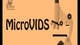 Science Uncovered MicroVIDS Episode 6: What is Alien Hand Syndrome?