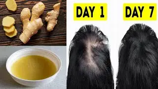 Ginger Oil For Hair Growth/Homemade Ginger Hair Oil/Ginger Oil/How To Make Ginger Oil At Home