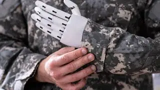 How the Amputee Coalition helps our Veterans