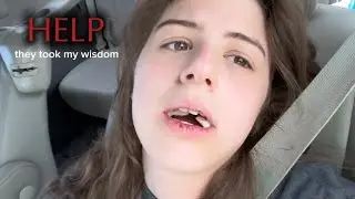 I GOT MY WISDOM TEETH REMOVED 