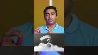 Travel-Friendly Teeth: Clear Aligners for NRI Convenience