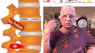 Disc Prolapse - Drugless pain relief through Reiki and Acupuncture- Dr P S Lalitha
