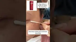 Creme Clareador Facial Removedor De Manchas Escuras E  Melasmas