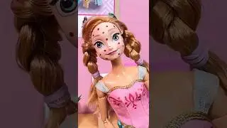 Barbie Facial Spa | Anna with Red Spots| kids channel
