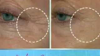 Miracle Eyes 2 min