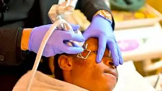 How to remove birthmarks II Birthmark removal by laser therapy  Dr Lalit Kasana  Dermatologist