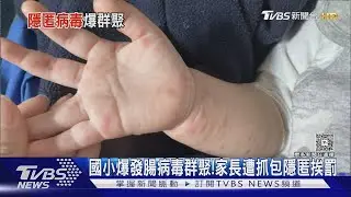 高雄貴族國小爆發腸病毒群聚! 醫師家長遭抓包隱匿挨罰｜TVBS新聞 @TVBSNEWS01