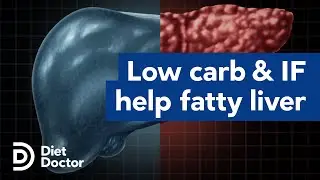 Low carb and intermittent fasting help fatty liver
