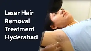 Laser Hair Removal Hyderabad | Cost of Permanent Hair Removal Treatment In Hyderabad
