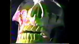OverDose Live at Gin&aacute;stico 19/04/1986 (