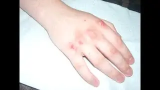 Bruised Knuckles SFX Make-Up / Ben Nye Bruise Wheel