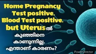 Very early signs of pregnancy |Momtalks