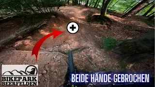 Beide H&auml;nde gebrochen / Bikepark Beerfelden / Juli 2025