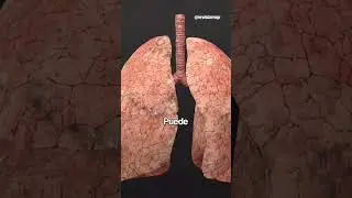 Pleures&iacute;a 😮&zwj;💨: cuando respirar duele | #Shorts