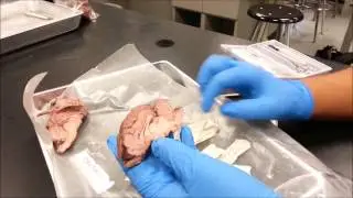 Sheep Brain: Dissection, Parts, and Functions