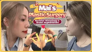 Revision Rhinoplasty & Breast Augmentation at Braun Plastic Surgery PART 2 [with Mai from Germany]