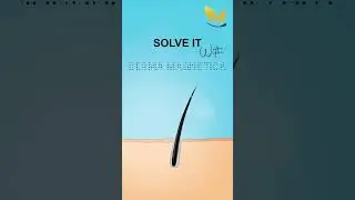 Derma Magnetica Customized Hair fall Solutions | Hair fall Treatments | Hair Fall issues.