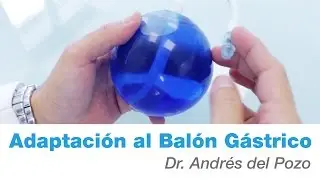 Postoperatorio Bal&oacute;n G&aacute;strico, &iquest;c&oacute;mo es?  | Cl&iacute;nicas Diego de Le&oacute;n