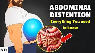 Abdominal Distention: What&rsquo;s Causing Your Belly to Swell, When to Worry & How to Fix It!