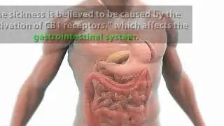 What You Need to Know  Cannabinoid Hyperemesis Syndrome