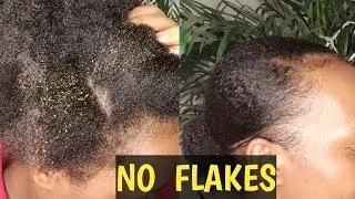 HOW TO GET RID OF GEL FLAKING ON NATURAL HAIR |STYLING DIRTY HAIR/jalia walda