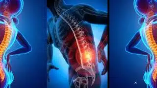 Back Pain Breakthrough Review ** Is It A Scam Or Real?