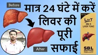 ये दवा लिवर की सारी गंदगी को बाहर निकाल देगी | Homeopathic Liver Tonic | SBL Liv-T Liver Tonic Uses