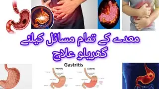 Gas, Acidity & Constipation | Gas, Qabz, IBS Ka Ilaj Jab Tests Normal Hon #stomach #qabzkaila #viral