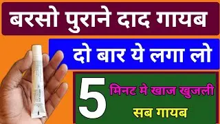 Raja maharajaon ke dad ko theek karne wali cream / Itrovax cream/ full review/ inch gard cream 