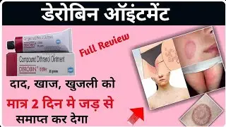 Derobin Cream Uses In Hindi | What is Derobin used for? | Derobin Ointment | Derobin