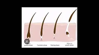 What is male pattern balding? Call 0769965660
