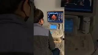 MCC Cardiovascular Sonography Training #shorts