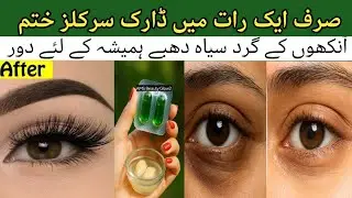 Say Goodbye to Dark Circles Overnight ĺ Easy Home Remedies | Get Rid Of Wrinkles | Anti-Aging Cream 