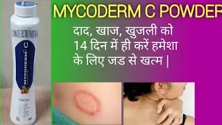Mycoderm c Dusting Powder ke fayde, lagane ka sahi tarika, uses, review in hindi || दाद, खाज, खुजली|