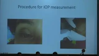 AIOS2022 FP92  Glaucoma  II topic Trans lid tonometry