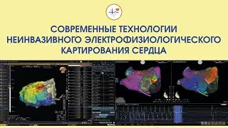 Современные технологии неинвазивного электрофизиологического картирования сердца