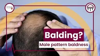 Male Pattern Baldness - Truth Be Told