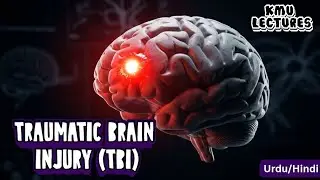 Traumatic Brain Injury (TBI): Causes, Diagnosis & Treatment | Urdu/Hindi