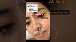 #Ryx #RyxSkin #GlowBomb #fypシ゚ #shorts #reelsvideo #budolfinds #shopeehaul #acne #pimpleproblem