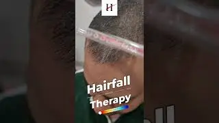 Get back your hair. #hairsolution #hairfallproblem #drchabra #hairfalltreatment #hairtreatment #hair