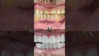 3 Jaw-Dropping Smile Transformations