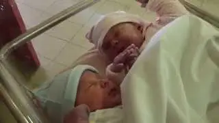 nos jumeaux &agrave; la naissance se tenant la main.