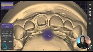 Mastering exocad 01 Fundamentals   Institute of Digital Dentistry 6